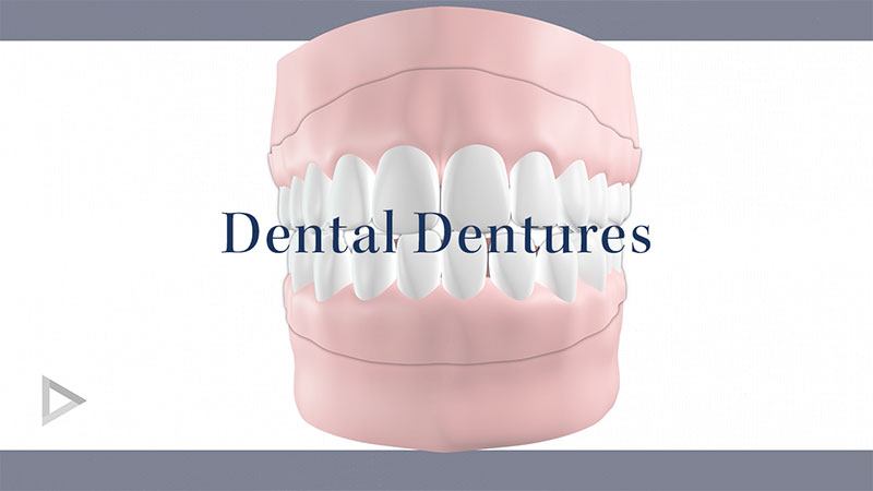 Dental Dentures