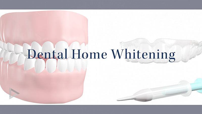 Home Whitening