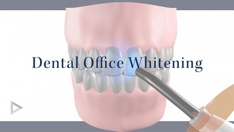 Office Whitening